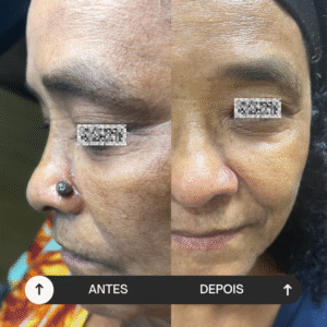 beige minimalist skincare before and after instagram post (1)