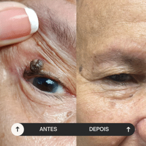 beige minimalist skincare before and after instagram post (2)