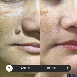 beige minimalist skincare before and after instagram post