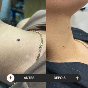 beige minimalist skincare before and after instagram post (4)