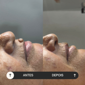 beige minimalist skincare before and after instagram post (5)