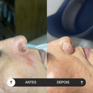 beige minimalist skincare before and after instagram post (6)