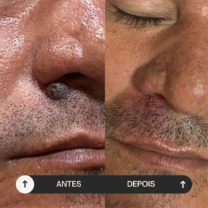 beige minimalist skincare before and after instagram post (9)